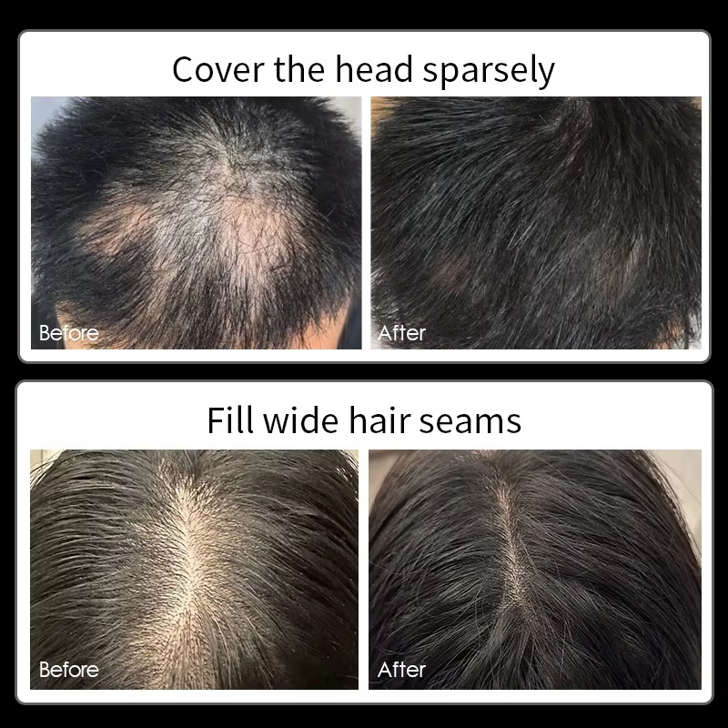 Waterproof Hairline Enhancement Spray – Hair Thickening Solution for Men