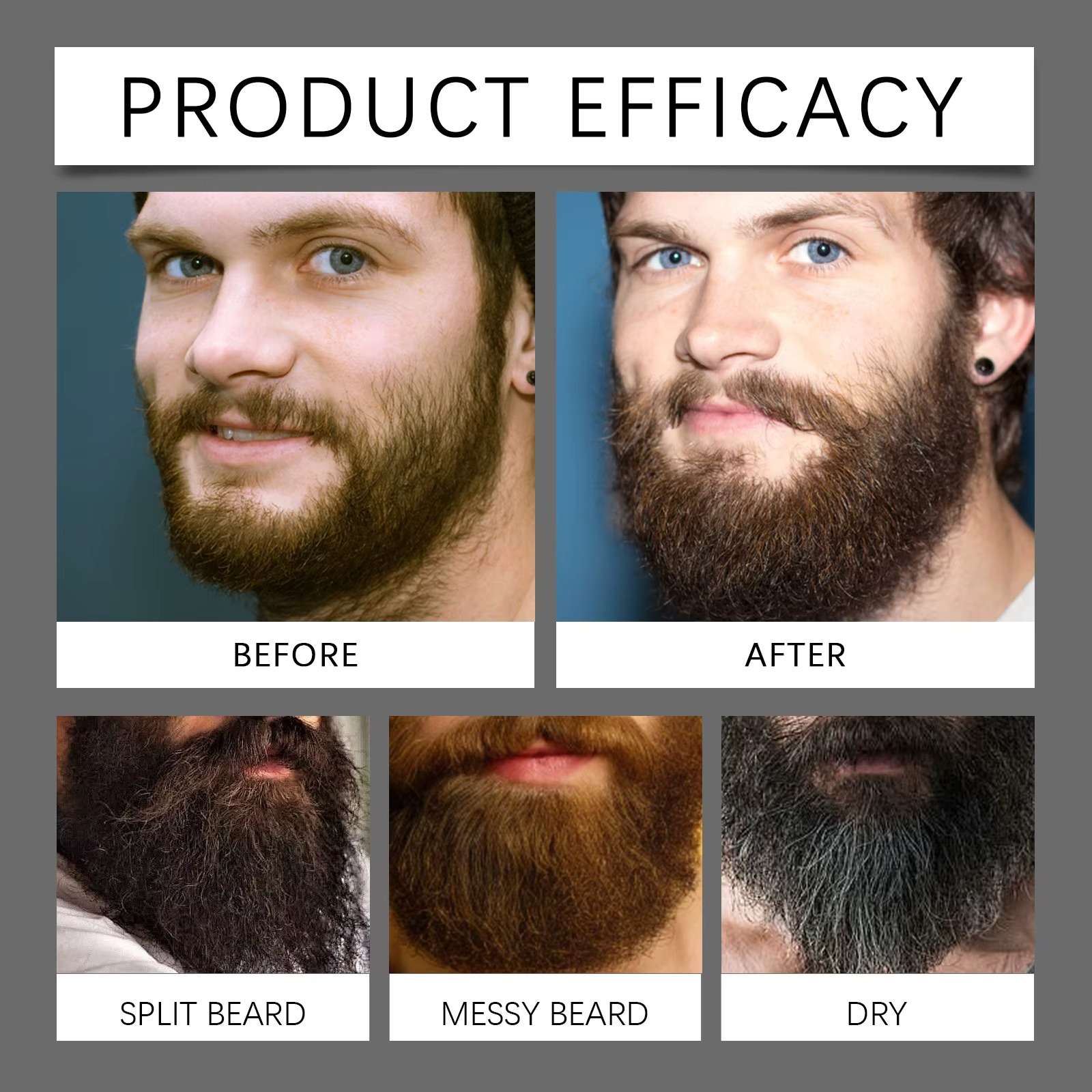 East Moon Beard Growth Serum Set – Beard Care & Growth Support